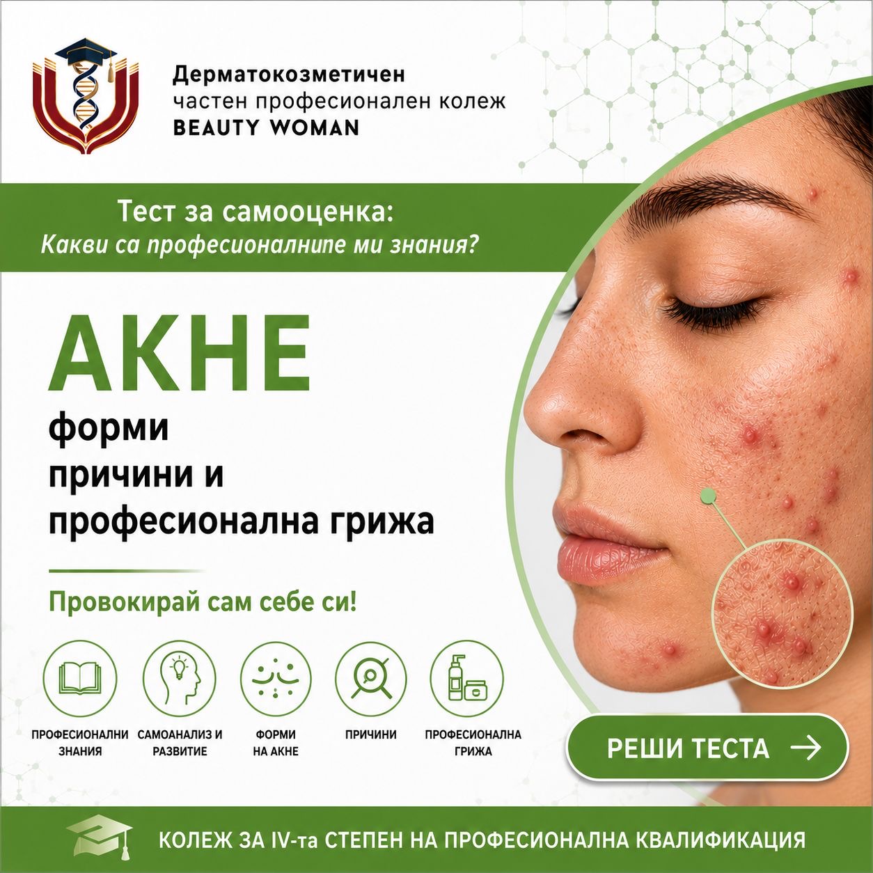 Акне – форми, причини и професионална грижа